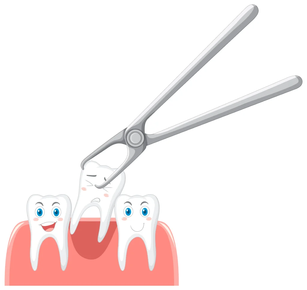 Can You Drink Water After Tooth Extraction